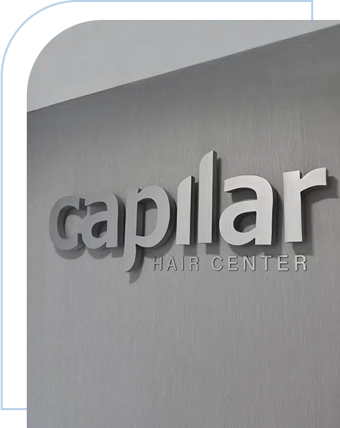 experts-in-treating-hair-loss-problems-capilar-hair-center-tijuana
