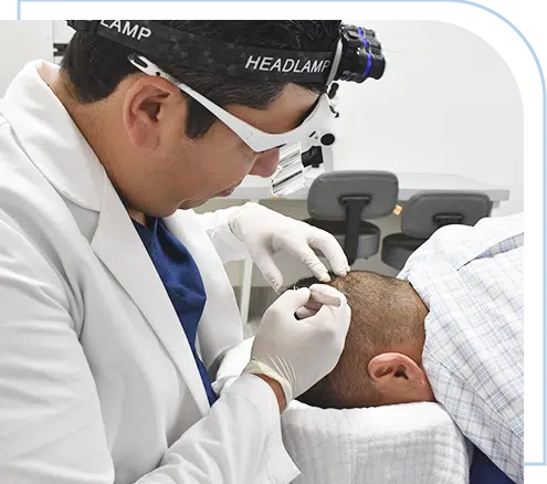 know-the-solution-androgenetic-alopecia-in-capilar-hair-center-tijuana