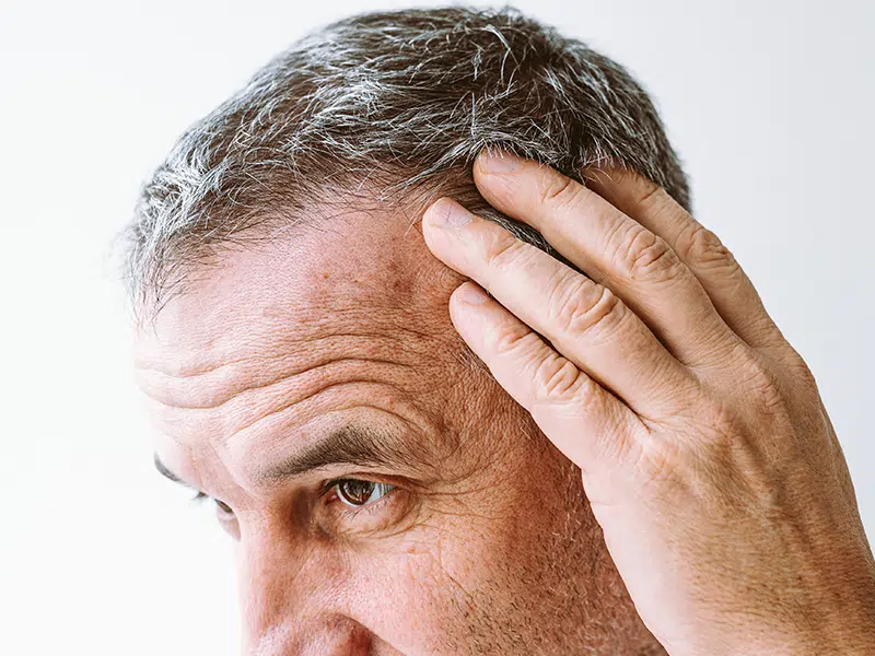 looking-for-expert-advice-on-effective-hair-loss-treatments