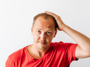 Fue Hair Transplant Eligibility Are You A Good Candidate