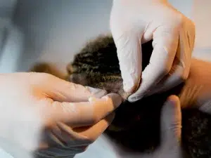 Hair Density Improvement Key Steps To Transform Your Hair